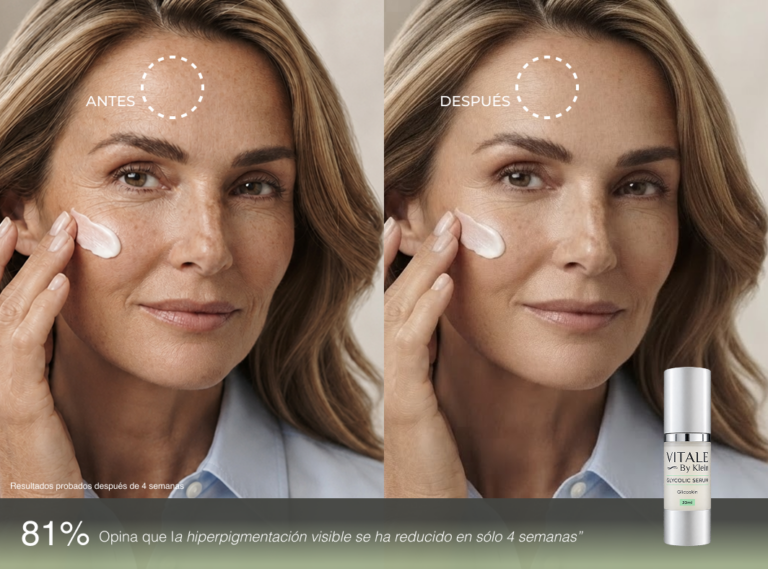 Glicolico - antes y despues