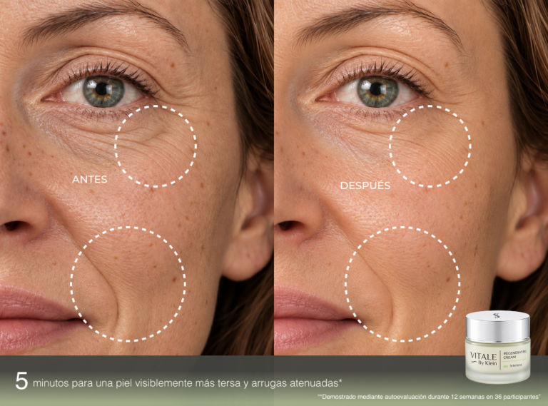 Regeneradora Crema Intense - antes y despues