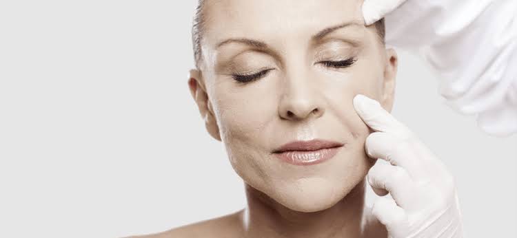 Flacidez facial Vitale By Klein