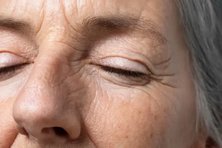 Qué es el fotoenvejecimiento y cómo prevenir sus signos